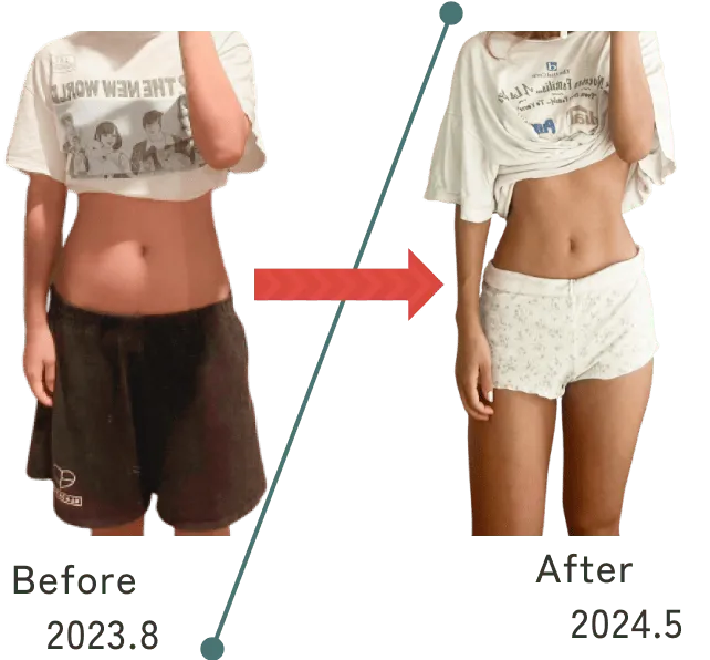 Yさんのビフォーアフター